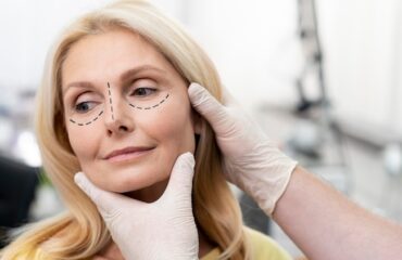 Відкритий погляд: чому не потрібно зволікати з блефаропластикою