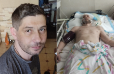 Чоловік до та після відвідування ТЦК