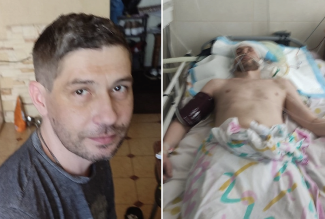 Чоловік до та після відвідування ТЦК