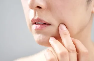 Як прибрати носогубні зморшки