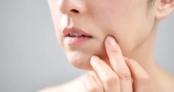 Як прибрати носогубні зморшки